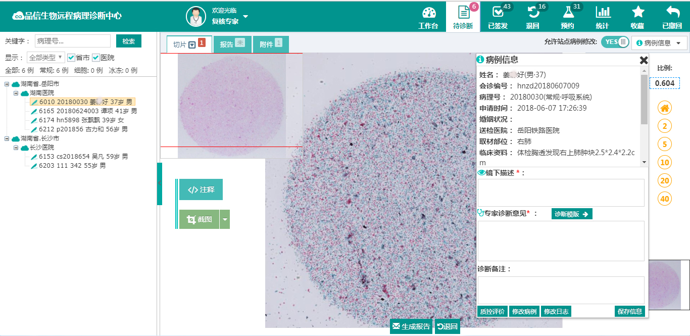 品信生物遠程病理診斷系統湖(hú)南定昌盛智能科(kē)|長(cháng)沙網站設計|長(cháng)沙手機網站|長(cháng)沙軟件公司|湖(hú)南軟件開(kāi)發|長(cháng)沙軟件定制|長(cháng)沙軟件開(kāi)發|長(cháng)沙微信小程序|長(cháng)沙網絡公司|長(cháng)沙軟件外包公司|長(cháng)沙競價托管